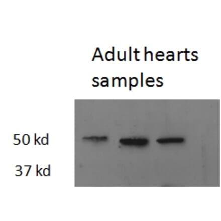 Western Blot - Anti-Thyroid Hormone Receptor beta Antibody (A82504) - Antibodies.com