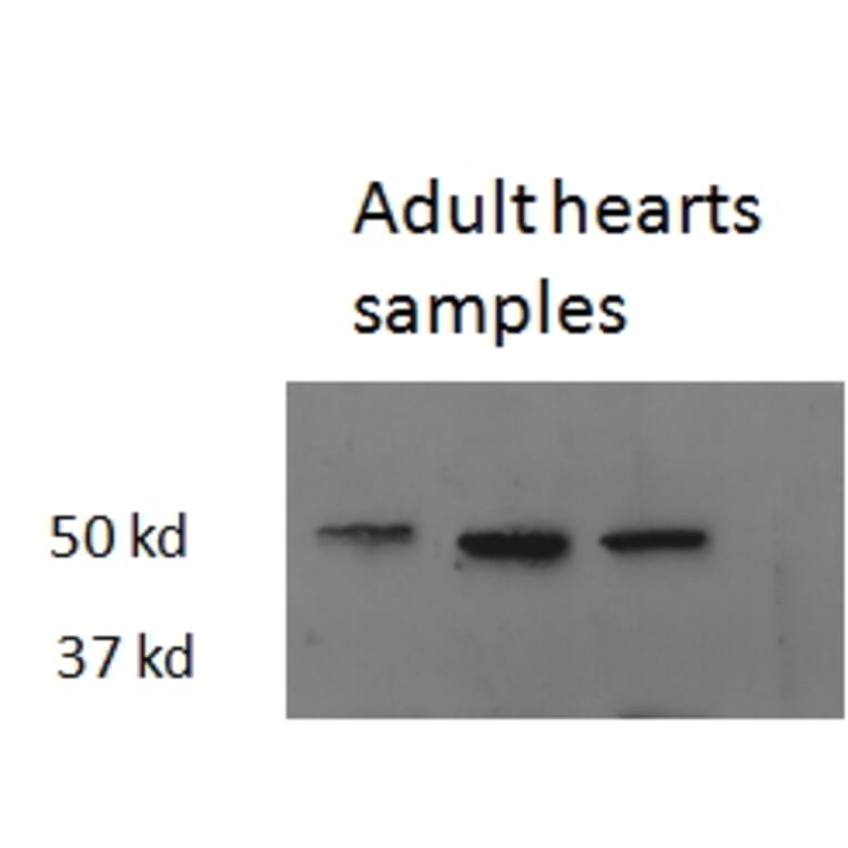 Western Blot - Anti-Thyroid Hormone Receptor beta Antibody (A82504) - Antibodies.com