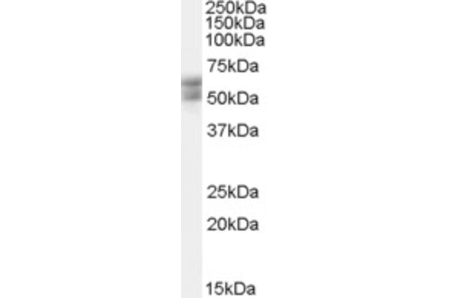 Western Blot - Anti-THRB Antibody (A82505) - Antibodies.com