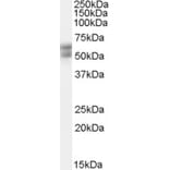 Western Blot - Anti-THRB Antibody (A82505) - Antibodies.com