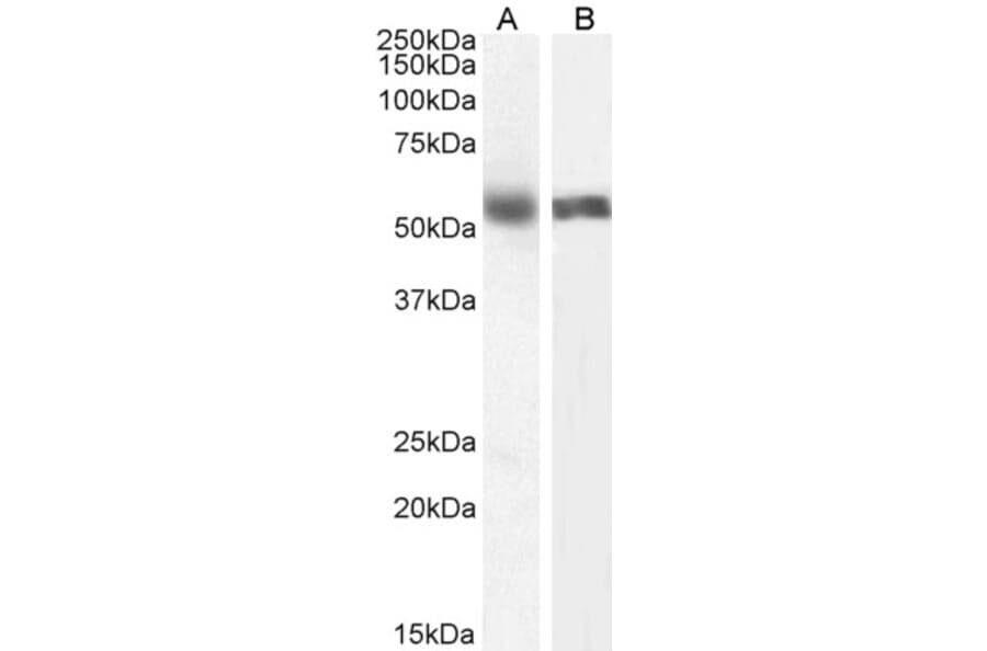 Western Blot - Anti-Cytochrome P450 1A2 Antibody (A82506) - Antibodies.com