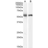 Western Blot - Anti-Cytochrome P450 1A2 Antibody (A82506) - Antibodies.com