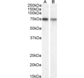 Western Blot - Anti-Chat Antibody (A82508) - Antibodies.com