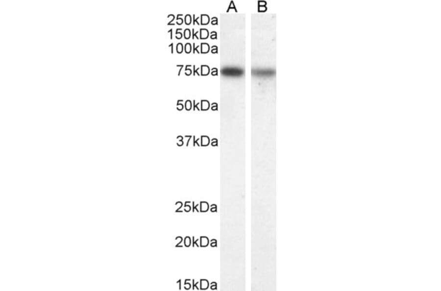 Western Blot - Anti-Chat Antibody (A82508) - Antibodies.com