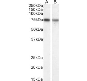 Western Blot - Anti-Choline Acetyltransferase Antibody (A82508)