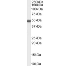 Western Blot - Anti-MBD2 Antibody (A82510) - Antibodies.com