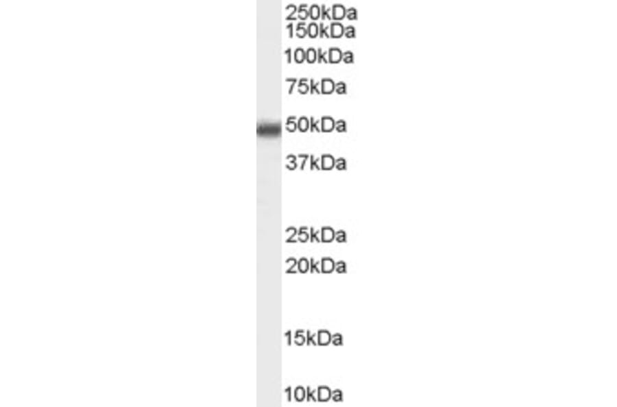 Western Blot - Anti-MBD2 Antibody (A82510) - Antibodies.com