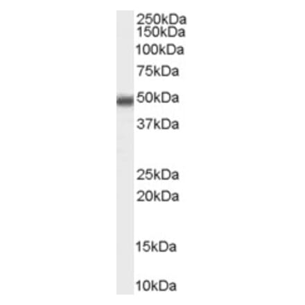 Western Blot - Anti-MBD2 Antibody (A82510)