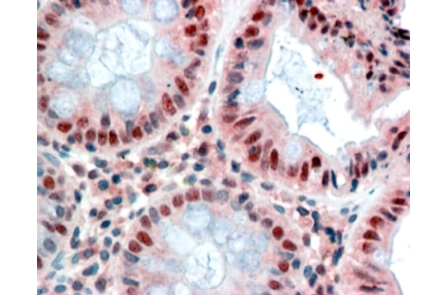 Immunohistochemistry - Anti-MBD2 Antibody (A82510) - Antibodies.com