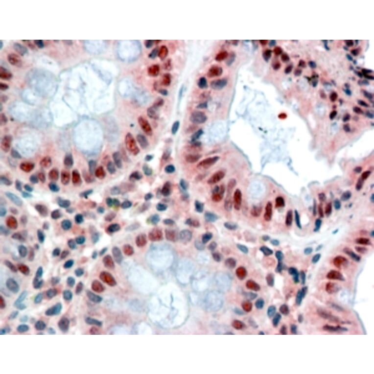 Immunohistochemistry - Anti-MBD2 Antibody (A82510) - Antibodies.com