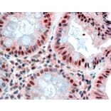 Immunohistochemistry - Anti-MBD2 Antibody (A82510) - Antibodies.com