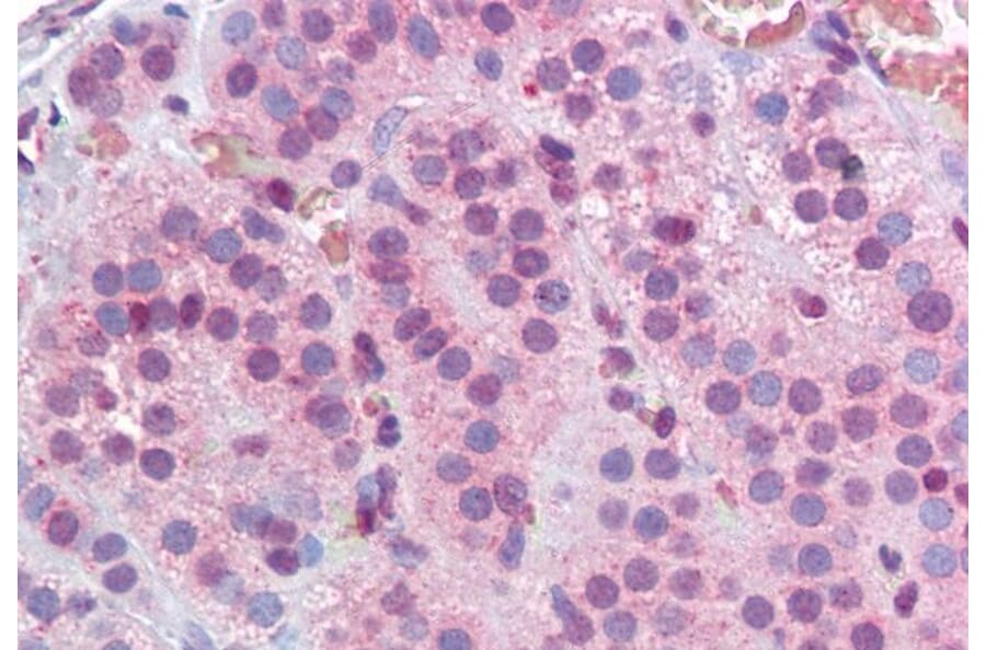 Immunohistochemistry - Anti-MBD2 Antibody (A82510) - Antibodies.com