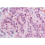 Immunohistochemistry - Anti-MBD2 Antibody (A82510) - Antibodies.com