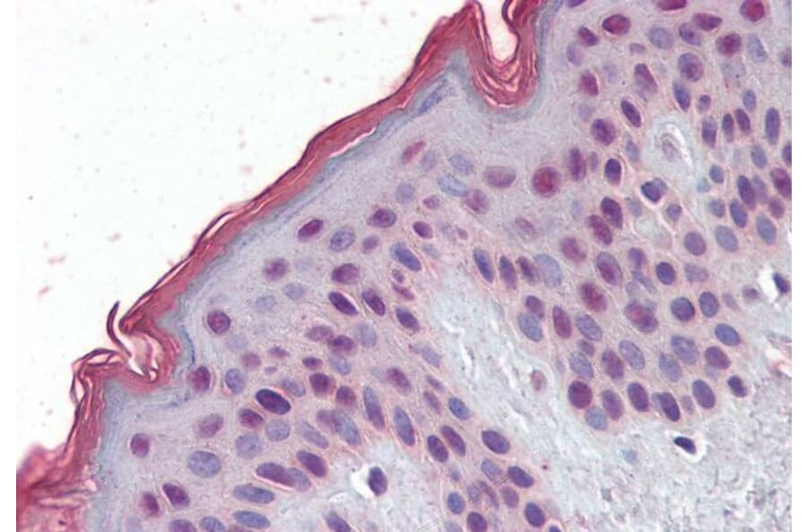 Immunohistochemistry - Anti-MBD2 Antibody (A82510) - Antibodies.com