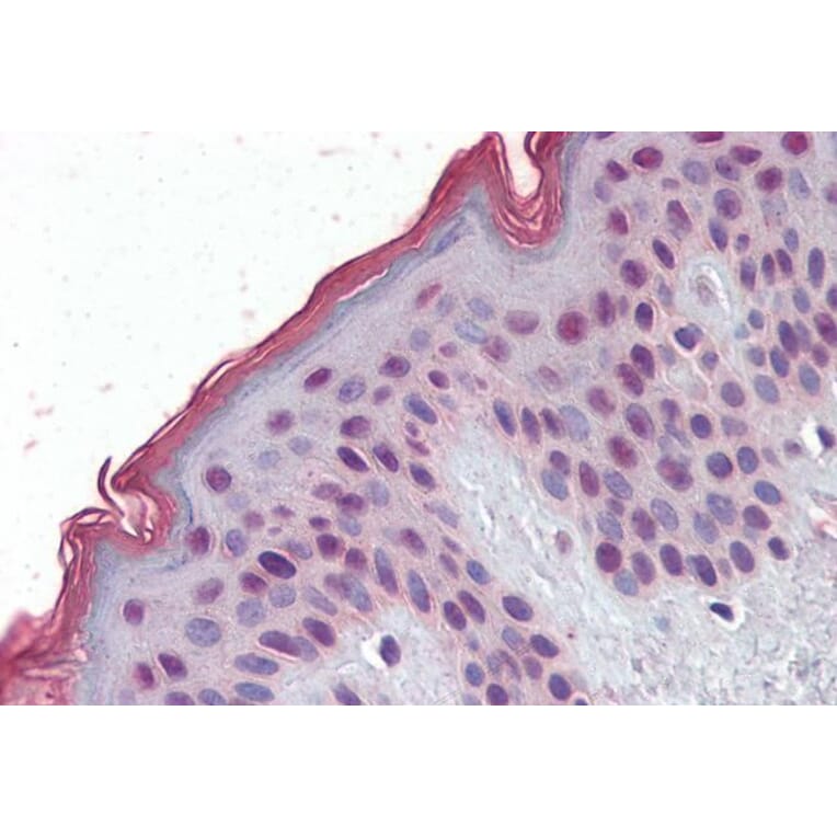 Immunohistochemistry - Anti-MBD2 Antibody (A82510) - Antibodies.com