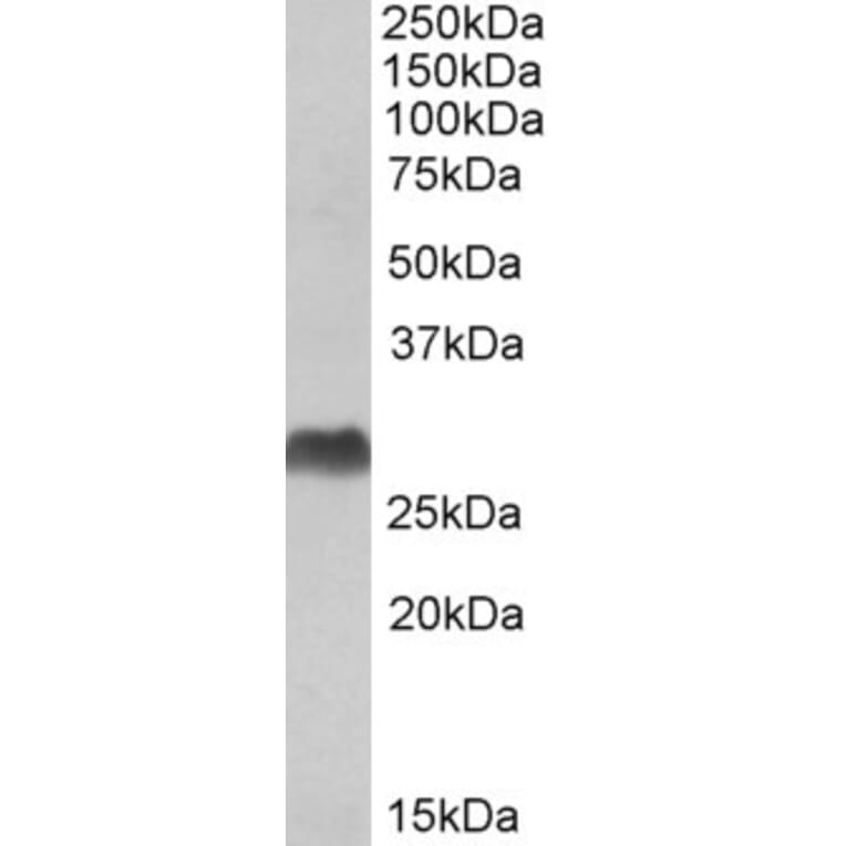 Western Blot - Anti-HLA-DQA1 + HLA-DQA2 Antibody (A82511) - Antibodies.com