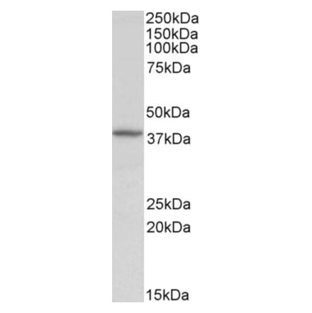 Western Blot - Anti-Decorin Antibody (A82517) - Antibodies.com