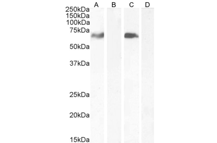 Western Blot - Anti-MARK4 Antibody (A82518) - Antibodies.com