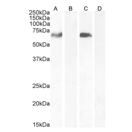 Western Blot - Anti-MARK4 Antibody (A82518) - Antibodies.com