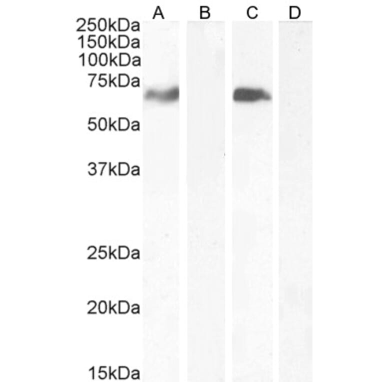 Western Blot - Anti-MARK4 Antibody (A82518) - Antibodies.com