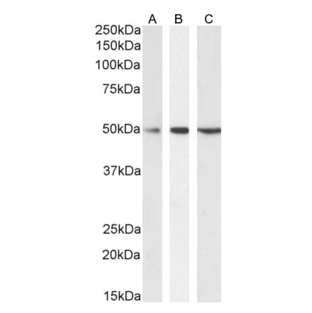 Western Blot - Anti-SEPT6 Antibody (A82519) - Antibodies.com