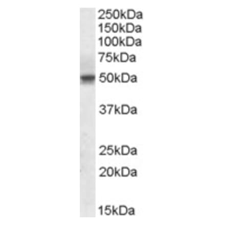 Western Blot - Anti-SEPT6 Antibody (A82519) - Antibodies.com