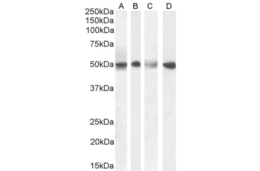 Western Blot - Anti-SEPT6 Antibody (A82519) - Antibodies.com