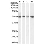 Western Blot - Anti-SEPT6 Antibody (A82519) - Antibodies.com