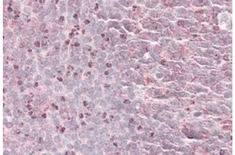 Immunohistochemistry - Anti-SEPT6 Antibody (A82519) - Antibodies.com