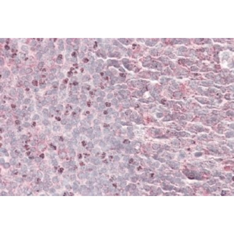 Immunohistochemistry - Anti-SEPT6 Antibody (A82519) - Antibodies.com
