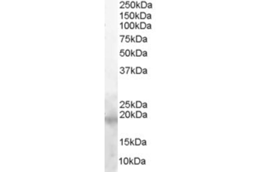 Western Blot - Anti-Survivin Antibody (A82521) - Antibodies.com