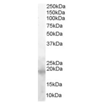 Western Blot - Anti-Survivin Antibody (A82521) - Antibodies.com