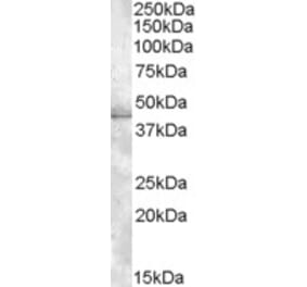 Western Blot - Anti-MBNL1 Antibody (A82522) - Antibodies.com