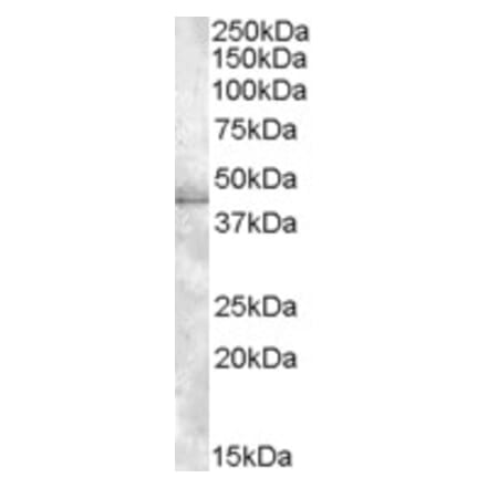 Western Blot - Anti-MBNL1 Antibody (A82522) - Antibodies.com