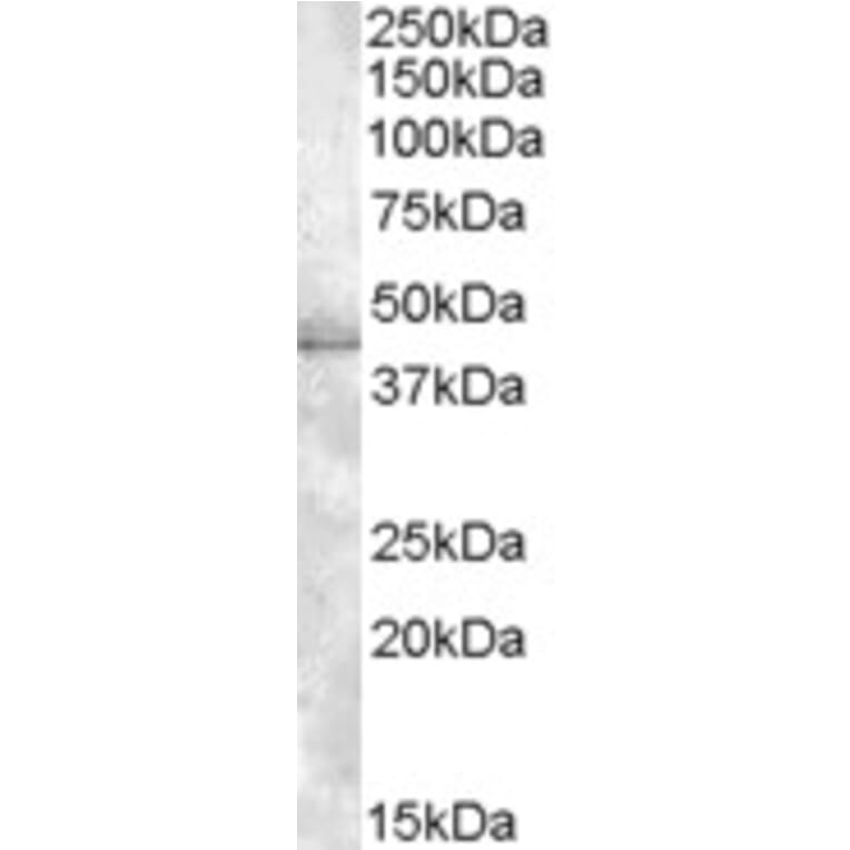 Western Blot - Anti-MBNL1 Antibody (A82522) - Antibodies.com