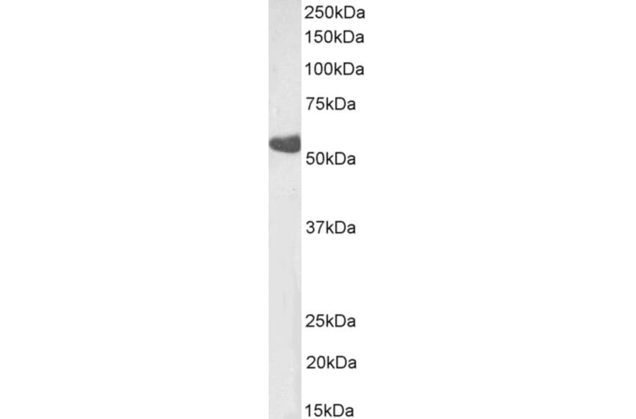 Western Blot - Anti-TBXA2R Antibody (A82523) - Antibodies.com