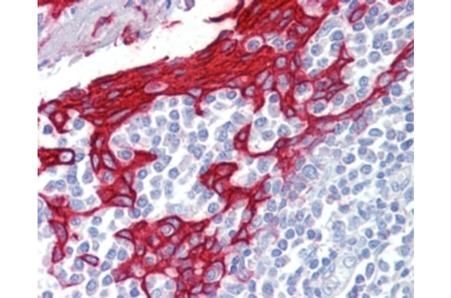 Immunohistochemistry - Anti-Cytokeratin 13 Antibody (A82524) - Antibodies.com
