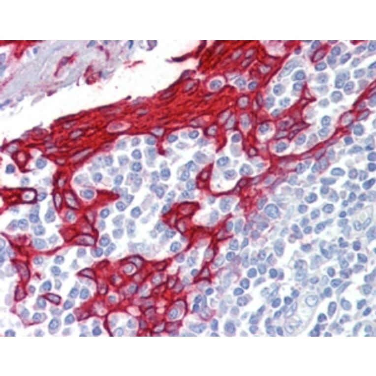 Immunohistochemistry - Anti-Cytokeratin 13 Antibody (A82524) - Antibodies.com