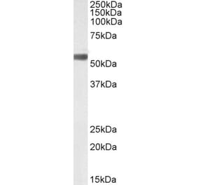 Western Blot - Anti-TGF beta 2 Antibody (A82525) - Antibodies.com