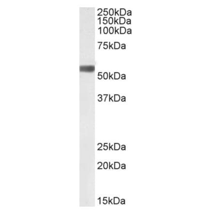 Western Blot - Anti-TGF beta 2 Antibody (A82525) - Antibodies.com