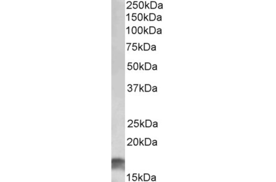 Western Blot - Anti-CDKN2A/p16INK4A Antibody (A82526) - Antibodies.com