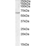 Western Blot - Anti-SERPINA10 Antibody (A82527) - Antibodies.com