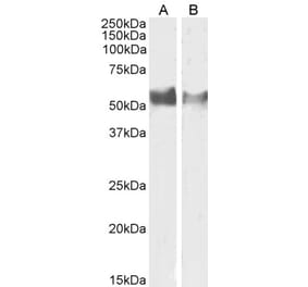 Western Blot - Anti-LAG-3 Antibody (A82528) - Antibodies.com