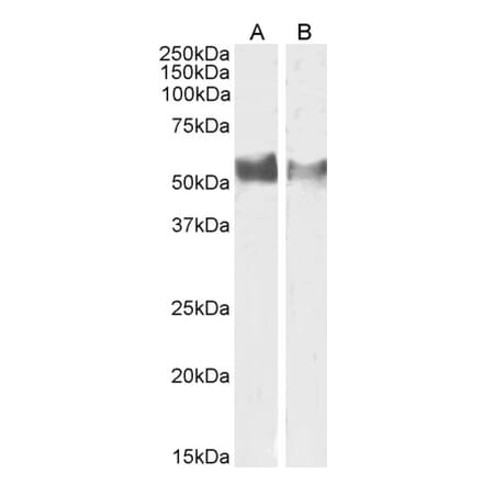 Western Blot - Anti-LAG-3 Antibody (A82528) - Antibodies.com