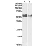 Western Blot - Anti-LAG-3 Antibody (A82528) - Antibodies.com