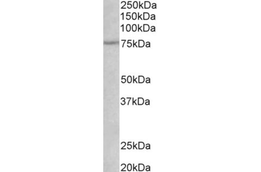 Western Blot - Anti-p75 NGF Receptor Antibody (A82529) - Antibodies.com