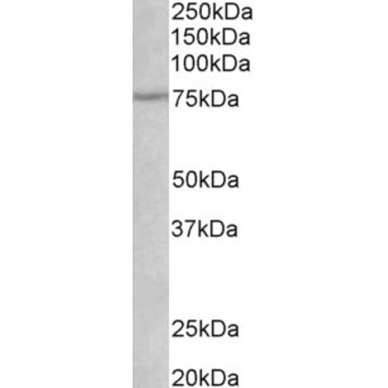 Western Blot - Anti-p75 NGF Receptor Antibody (A82529) - Antibodies.com