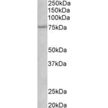 Western Blot - Anti-p75 NGF Receptor Antibody (A82529) - Antibodies.com