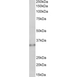 Western Blot - Anti-Caspase-6 (alpha) Antibody (A82531) - Antibodies.com