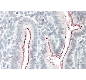 Immunohistochemistry - Anti-BCAR1 Antibody (A82532) - Antibodies.com